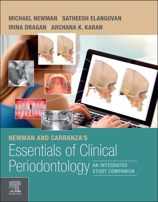 Newman and Carranza’s Essentials of Clinical Periodontology 2022
