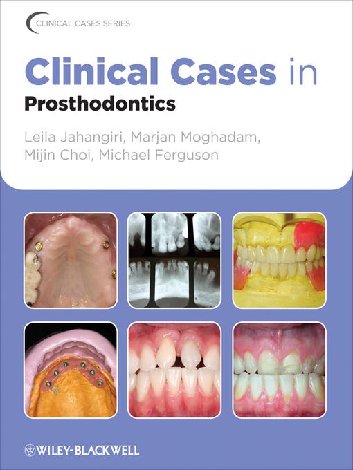 Clinical Cases in Prosthodontics 2011