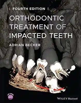 Orthodontic Treatment Of Impacted Teeth 2022