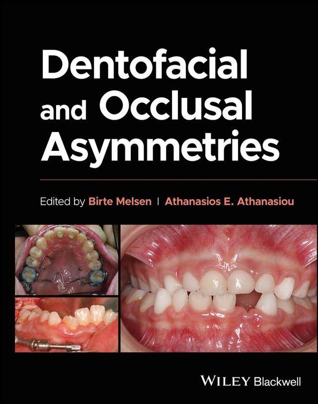 Dentofacial and Occlusal Asymmetries 2025