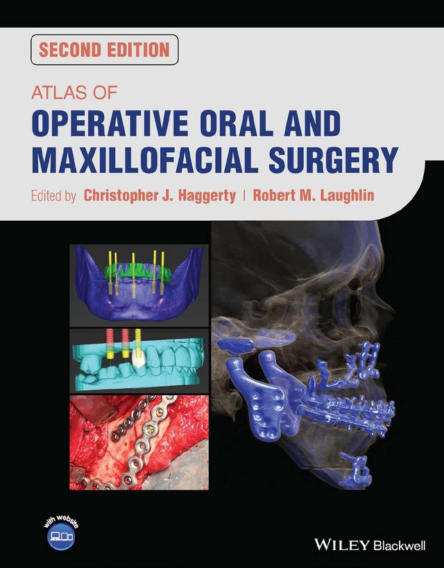 Atlas of Operative Oral and Maxillofacial Surgery 2023