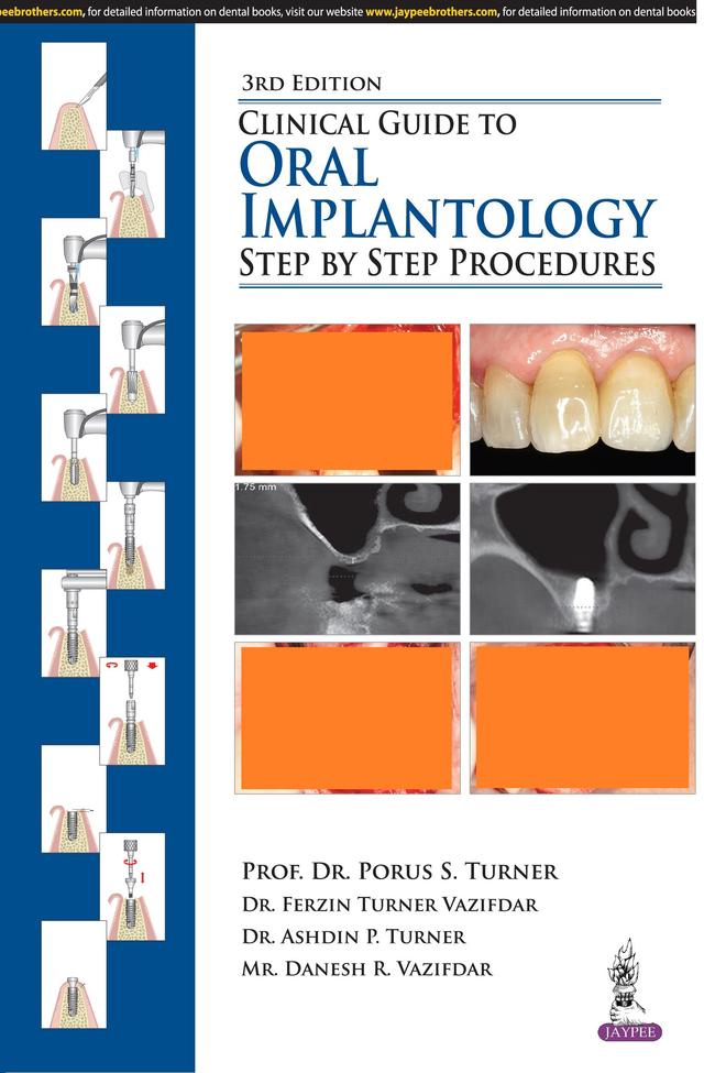 Clinical Guide to Oral Implantology Step by Step Procedures 2018