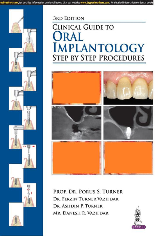 Clinical Guide to Oral Implantology Step by Step Procedures 2018