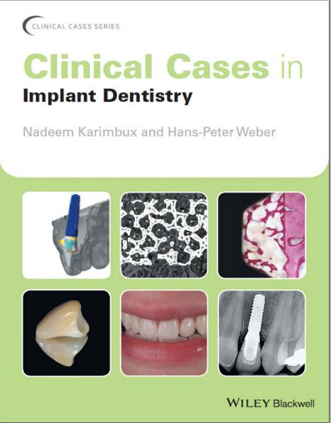 Clinical Cases in Implant Dentistry 2017