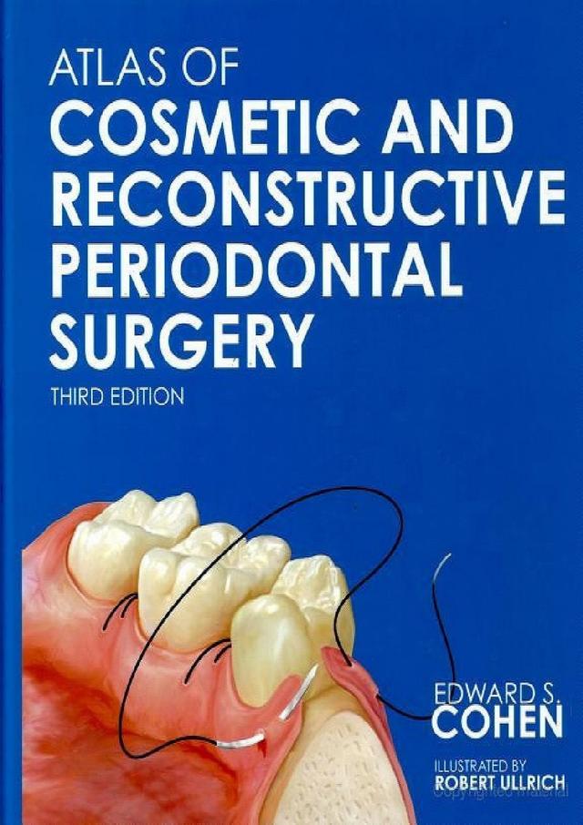 Atlas of Cosmetic And Reconstructive Periodontal Surgery 2007