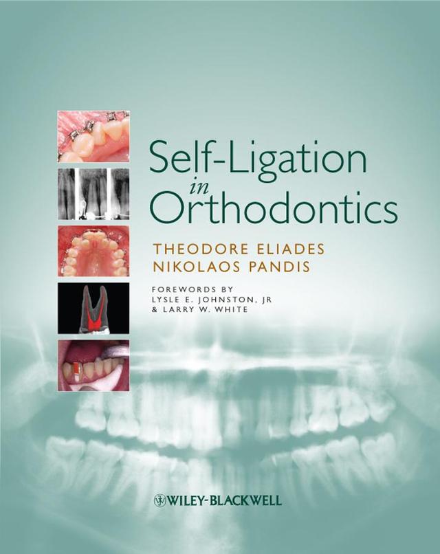Self-Ligation in Orthodontics 2009