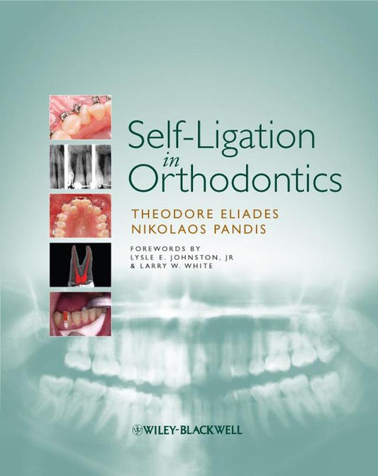 Self-Ligation in Orthodontics 2009