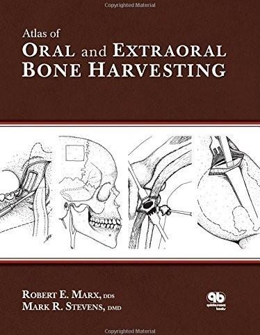 Atlas of Oral and Extraoral Bone Harvesting 2010