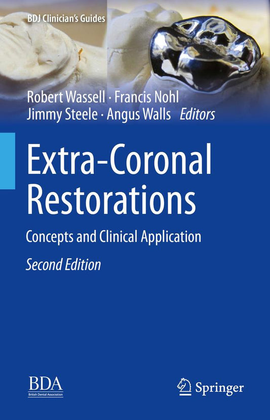 Extra-Coronal Restorations 2019