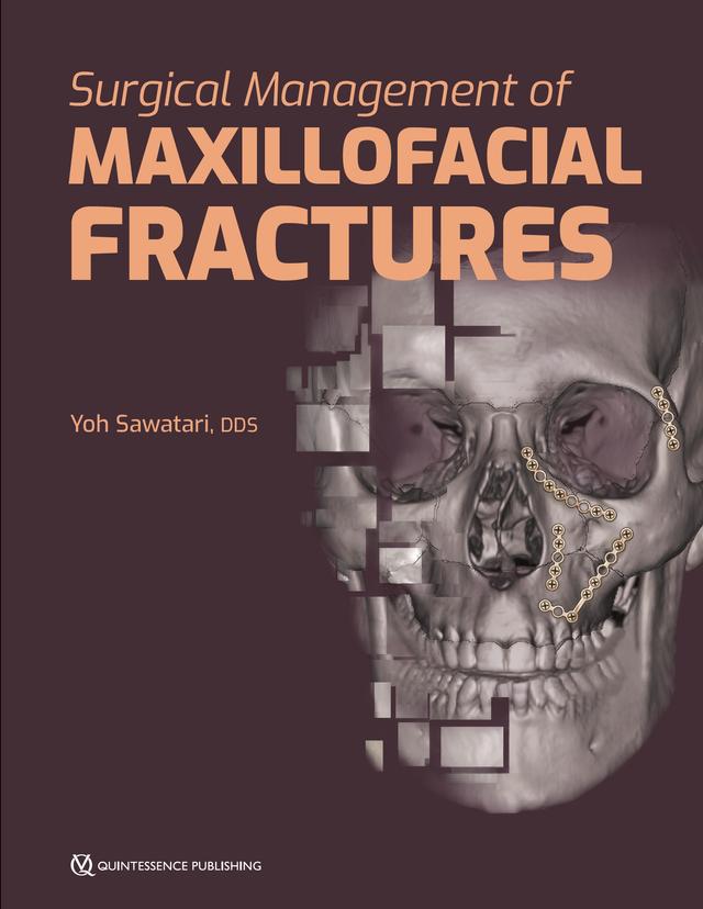 Surgical Management of Maxillofacial Fractures 2019