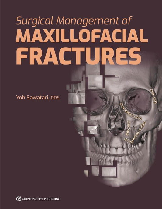Surgical Management of Maxillofacial Fractures 2019