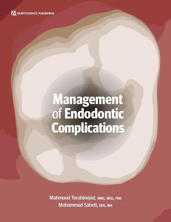Management of Endodontic Complications From Diagnosis to Prognosis 2023