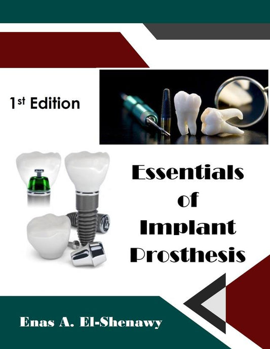 Essentials of Implant Prosthesis 2019
