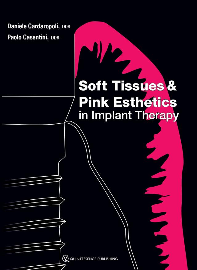 Soft Tissues and Pink Esthetics in Implant Therapy 2020