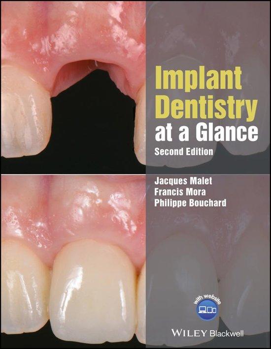 Implant Dentistry at a glance 2018