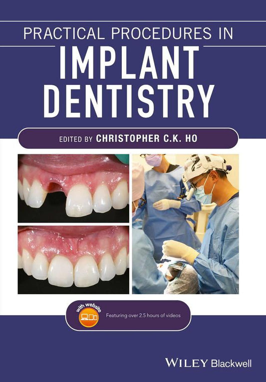 Practical Procedures in Implant Dentistry 2022