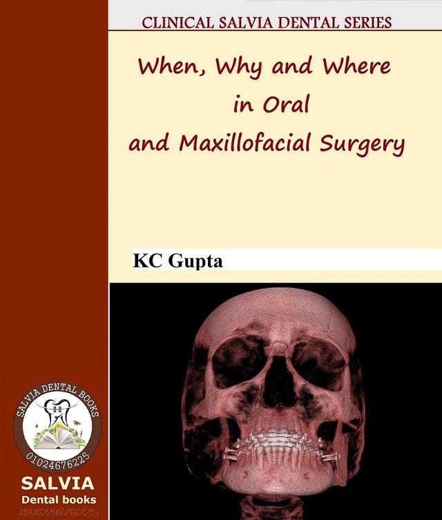 When, Why and Where in Oral and Maxillofacial Surgery