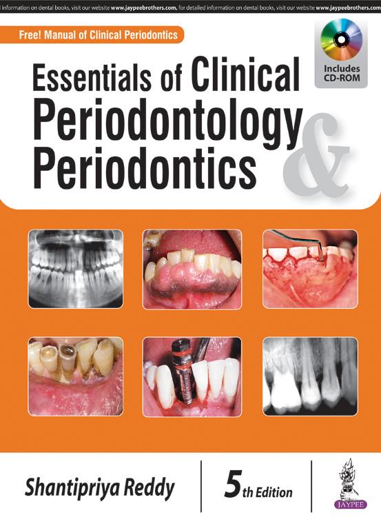 Essentials Of Clinical Periodontology & Periodontics 2018