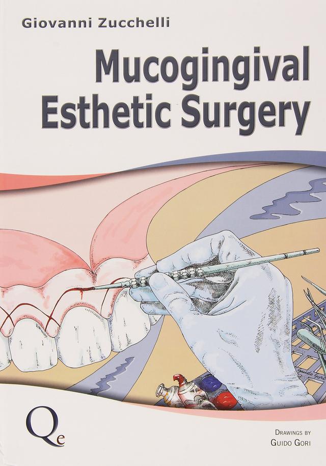 Mucogingival Esthetic Surgery 2013