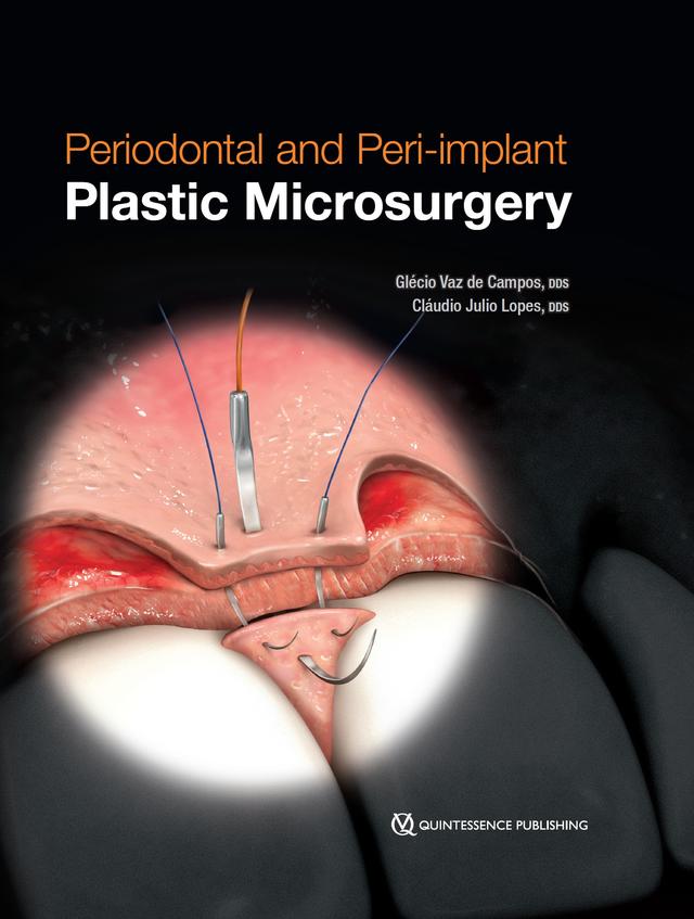 Periodontal and Peri-implant Plastic Microsurgery 2021